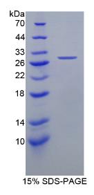 SDS-PAGE (HDLBP-7856H).jpg